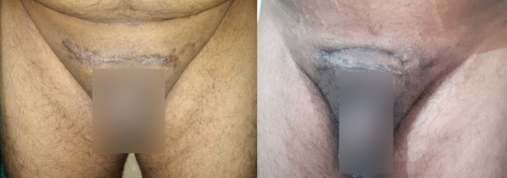 picture4