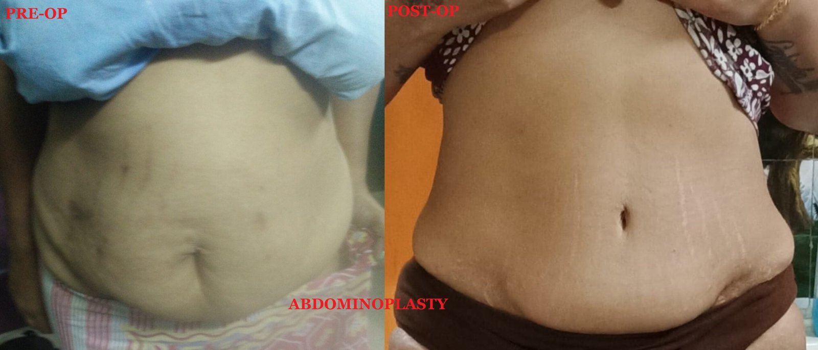 imgonline com ua twotoone xv012ctpn7