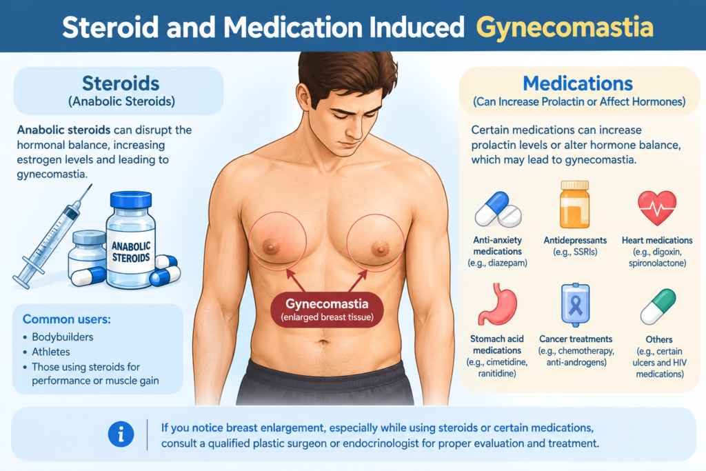 Steroid Induced Gynecomastia